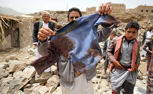 اليمن.. 1850 قتيلا و 546 ألف نازح في شهرين